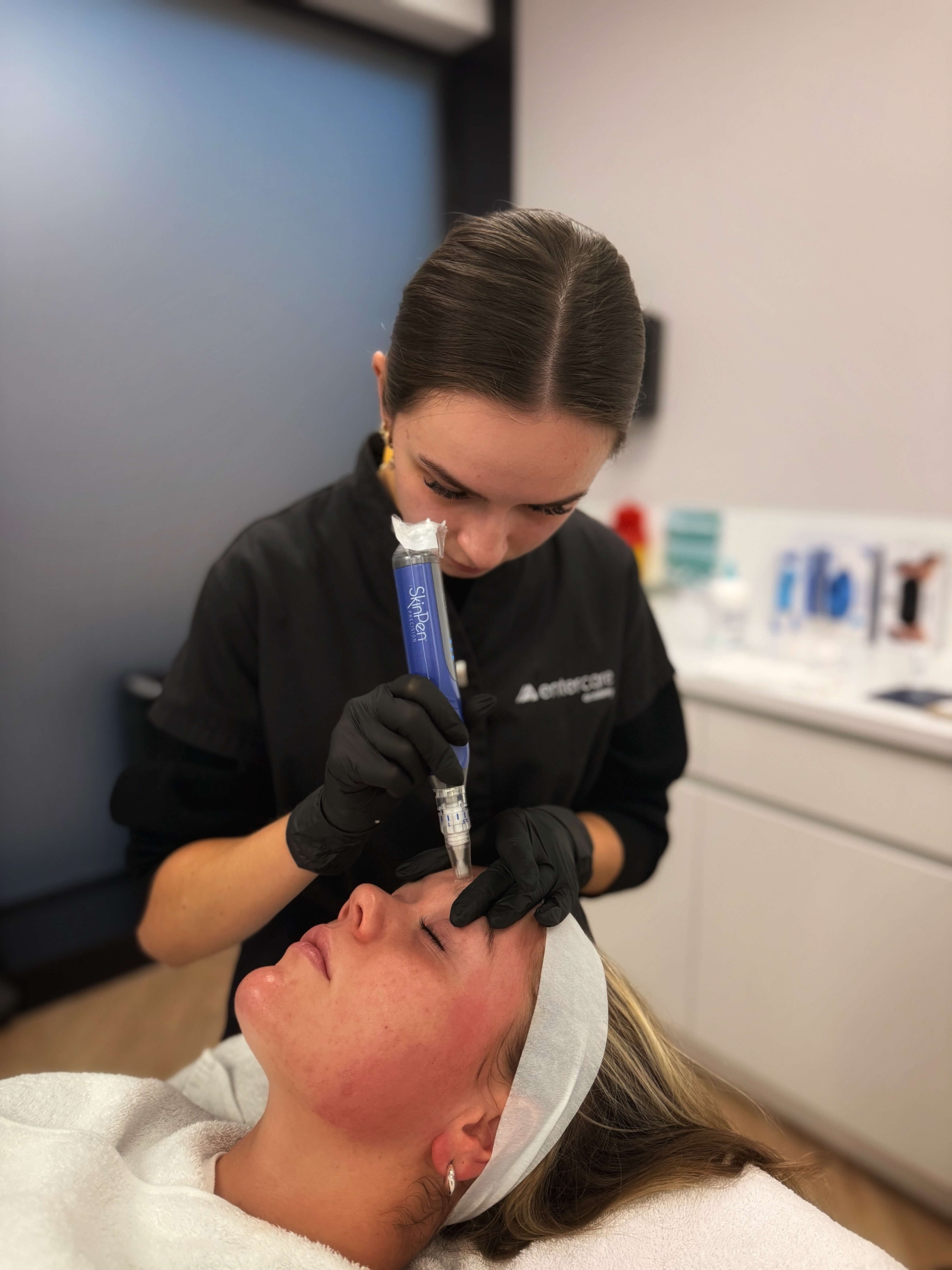 Specialist voert een SkinPen microneedling behandeling uit op het voorhoofd van een ontspannen klant